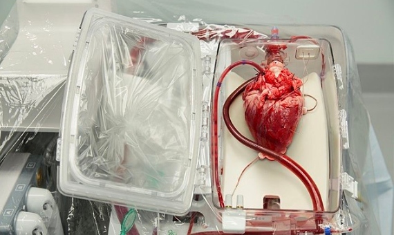 BBVA-OpenMind-Lo ultimo en trasplantes- xenotrasplantes a la impresion 3D 1-Los nuevos sistemas de conservación como la perfusión han mejorado el estado de los órganos destinados a trasplantes. Imagen: Wikimedia