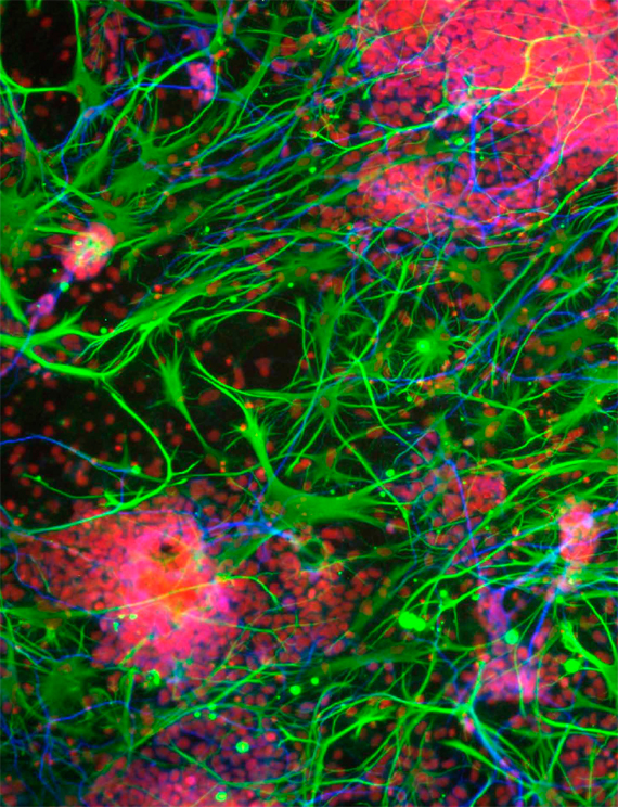 BBVA, OpenMind. Neurotechnological Progress: The Need for Neuroethics. Giordano. Fluorescence light micrograph of neural (nerve) stem cells that have been derived from human embryonic stem cells (HESC).