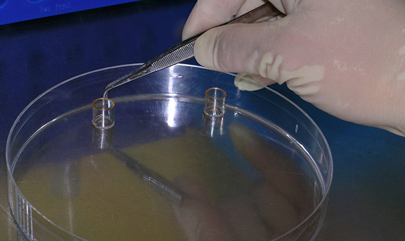 Clonaci贸n in vitro de una l铆nea celular humana usando anillos de clonaci贸n. Cr茅dito: Bob Walker-Jacopo Werther.