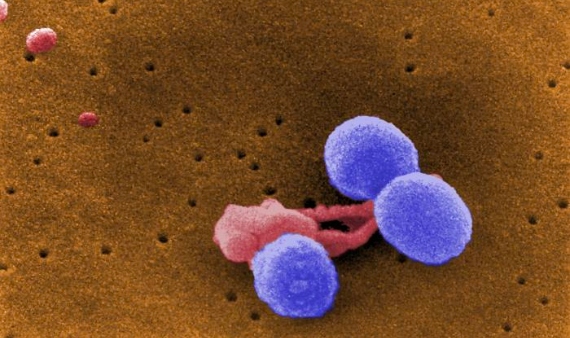 Â Tres bacteriasÂ Streptococcus pneumoniaeÂ (morado)Â son atacadas por un glÃ³bulo blanco (en rojo). Imagen: Wikimedia.