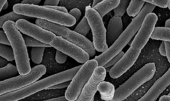 Imagen micorscÃ³pica de un cultivo de Escherichia coli. Imagen: Wikimedia