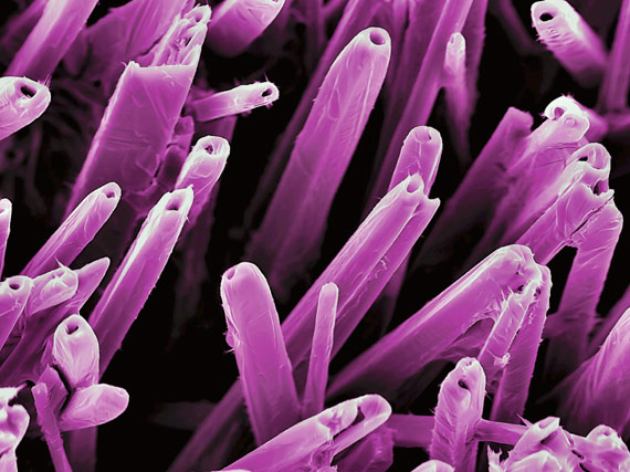 Colored scanning electron micrograph (SEM) of nanostructures formed on a vanadium and vanadiumoxide surface by a carbon-dioxide laser beam. The resulting nanostructures can have applications in various forms of electronics and nanotechnology