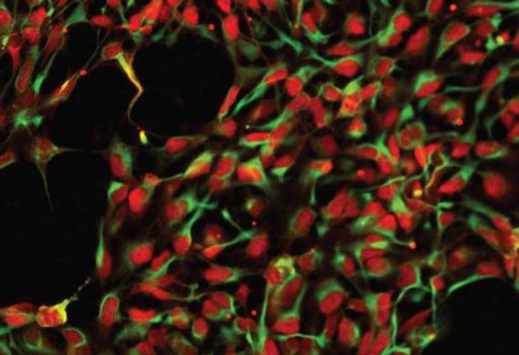 Células progenitoras neuronales diferenciadas de células SCNT-ESC. Crédito: Center for Embryonic Cell & Gene Therapy