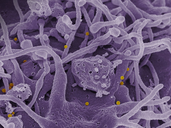 BBVA-OpenMind-Materia-Enemigos microscópicos_ los contagios que nos amenazan-Virus 2