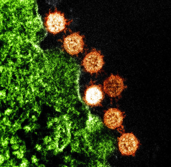 BBVA-OpenMind-Materia-Enemigos microscópicos_ los contagios que nos amenazan-Virus 5-Microscopic enemies