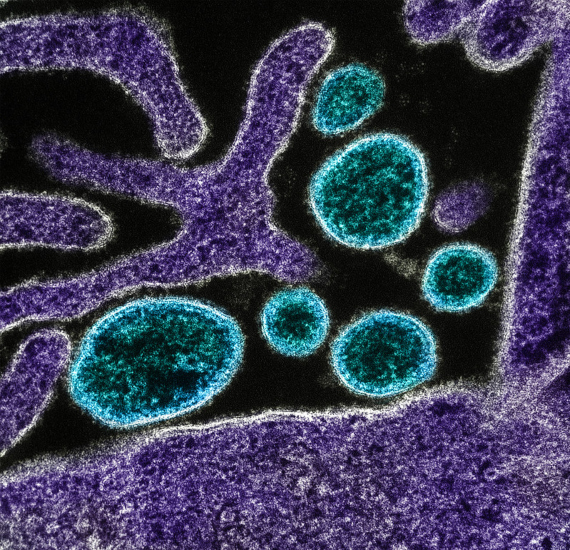 BBVA-OpenMind-Materia-Enemigos microscópicos_ los contagios que nos amenazan-Virus 6