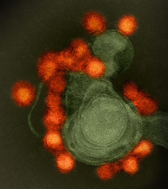 BBVA-OpenMind-Materia-Enemigos microscópicos_ los contagios que nos amenazan-Virus 8