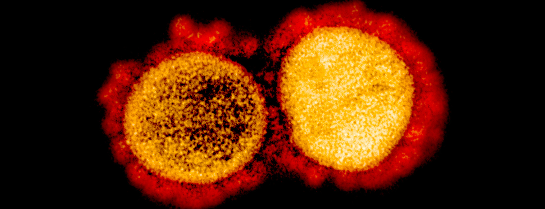 Qué sabe la ciencia sobre el coronavirus y qué ha logrado en su ...
