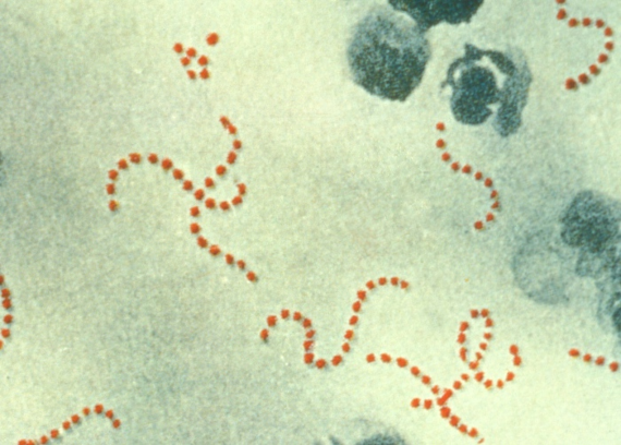 BBVA-OpenMind-Francisco Doménech-descubrió que lavarse las manos salva vidas-Semmelweis 3Fotomicrografía de la 'Streptococcus pyogenes’, bacteria responsable de la mayoría de casos graves de la fiebre del parto. Crédito: PD-USGov-HHS-CDC