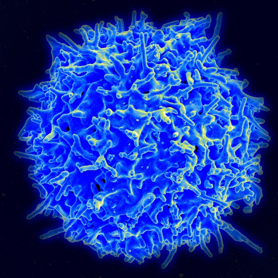 Un linfocito T humano (también llamado célula T) del sistema inmune de un donante sano. Crédito: NIAID-BBVA-OpenMind-Materia-Inmunidad al coronavirus 2
