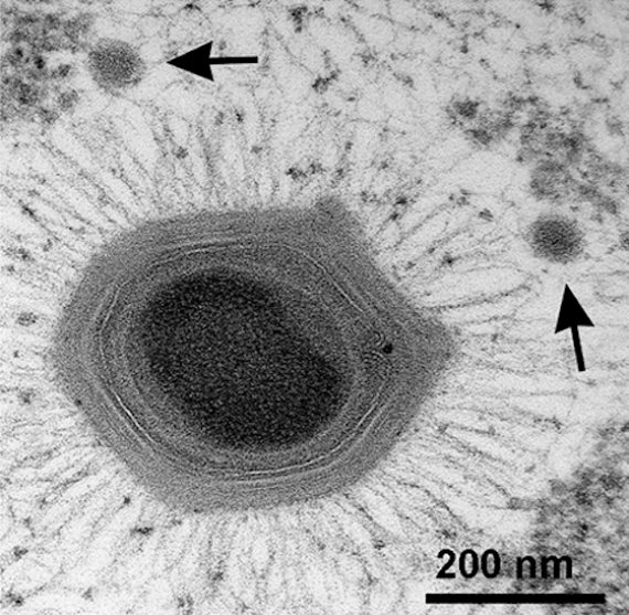 BBVA-OpenMind-Fuco-El origen de los virus, un enigma que nos ayudará a entender la evolución 1-Mimivirus gigante, con dos virófagos satélites Sputnik, que desafían la propia definición de los virus. Crédito: Sarah Duponchel y Matthias G. Fischer
