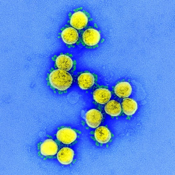 BBVA-OpenMind-La estacionalidad del coronavirus-Estacionalidad 5-Partículas del virus SARS CoV-2. Crédito: NIAID