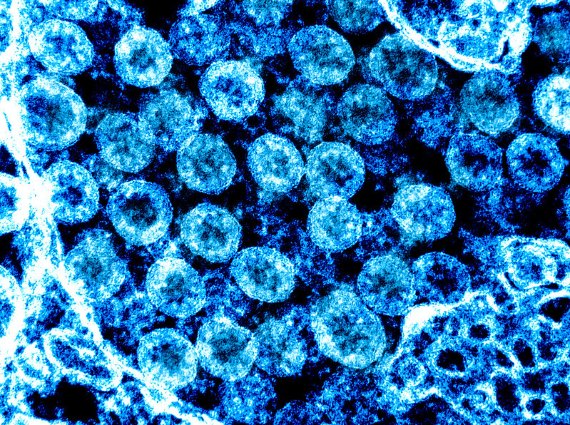 BBVA-OpenMind-Materia-Cómo acabará la pandemia de COVID-19-Fin del COVID_3-Micrografía electrónica de transmisión de partículas del virus del SARS-CoV-2. Crédito: NIAID