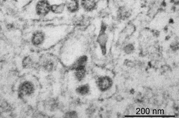 El estudio de virus animales con capacidad potencial de infectar a humanos, como el Sars-CoV-2 de la imagen, es una de las principales herramientas de prevención. Fuente: <strong>Universidad de Zaragoza</strong>