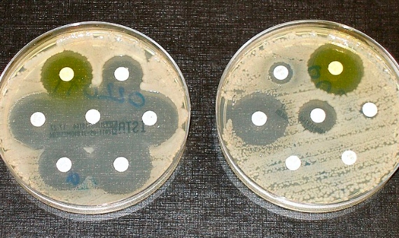 BBVA-OpenMind-Yanes-Resistencia a los antibioticos 1-La resistencia a los antibi├│ticos se muestra en estas placas. A la izquierda, las bacterias son sensibles a los antibi├│ticos probados mientras que en la de la derecha solo tres muestran sensibilidad. Imagen: Wikimedia