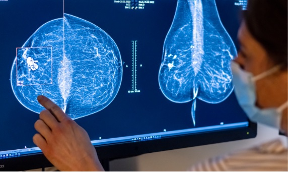 BBVA-OpenMind-Perez de Pablos-Sismologo diagnostica cancer de mama con ultrasonidos_2 El proceso empleado resulta en imágenes potencialmente mejores que las de una mamografía, además de que al tratarse de ultrasonidos, la prueba es inocua para las pacientes. Crédito: Getty Images
