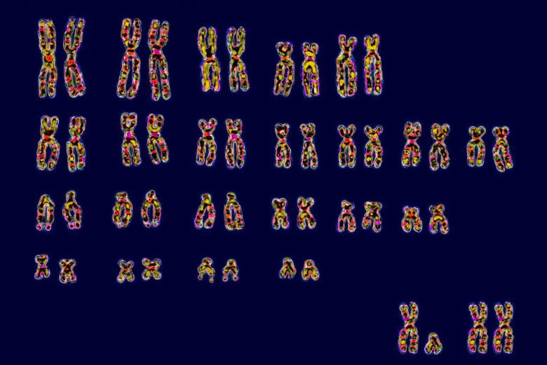 BBVA-OpenMind-Yanes-Cuanto nos parecemos geneticamente a un platano_2 Los genomas de los gemelos comienzan siendo idénticos en el proceso embrionario, pero a medida que las células se dividen, pueden aparecer mutaciones espontáneas. Crédito: Michael Duerinckx/Getty Images. / Universal Images Group via Getty Images