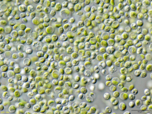 BBVA-OpenMind-Yanes-Los parasitos mas extranos de los humanos_8 La prototecosis está causada por el alga Prototheca, que ha perdido la capacidad de fotosintetizar y se ha especializado en alimentarse de materia orgánica. Crédito: ja:User:NEON / User:NEON_ja /CC BY-SA 3.0.
