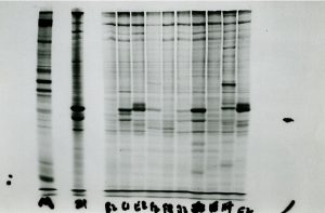En los años 60 y 70, con los primeros experimentos que demostraban la introducción estable de genes exógenos en las células, fue cuando empezó a idearse el concepto de terapia génica. Crédito: Images Group via Getty Images.