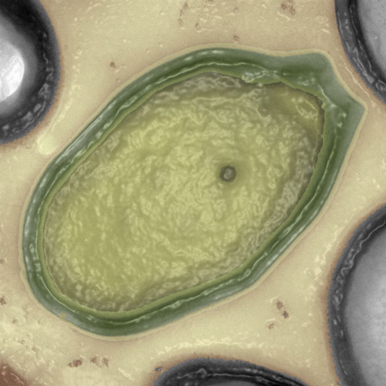 BBVA-OpenMind-Yanes-Son peligrosos los virus del hielo_3 Virus como el Pandoravirus yedoma, el más antiguo conocido con una edad de 48.500 años, infectan solo a amebas, organismos unicelulares, y son inofensivos para el ser humano. Crédito: IGS CNRS-AMU.